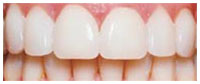 after treatment image