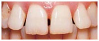 before treatment image